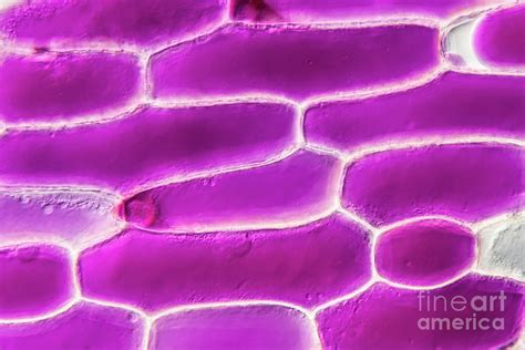 Onion Epidermis Plasmolysis Photograph by Gerd Guenther/science Photo Library - Fine Art America