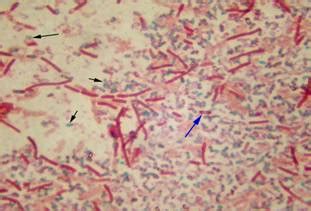 Endospore Stain