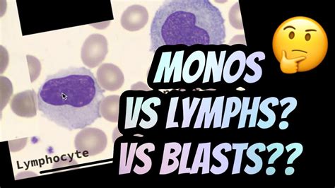 How to distinguish between Lymphocytes vs Monocytes