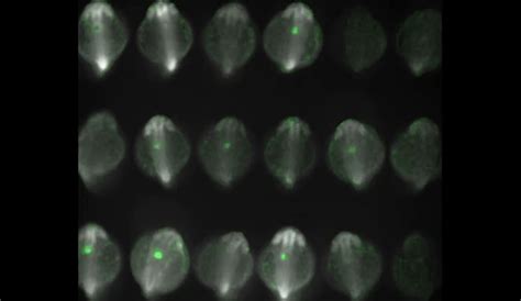 How the Heart Starts Beating | Harvard Medical School