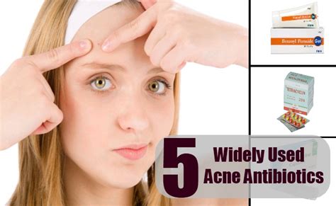 acne antibiotics - pictures, photos