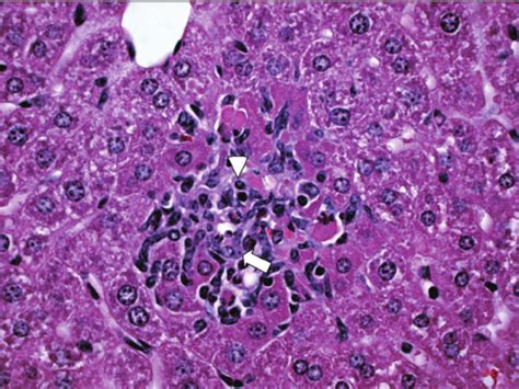 Inflammation of the cecum in the mouse colitis model. (A) Normal ...