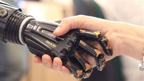 Boy, 10, to get bionic hand in time for Christmas | Fox News