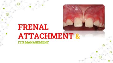 FRENAL ATTACHMENT & ITS MANAGEMENT | PPT