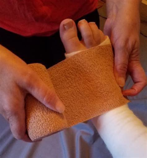 The Rap on Wrapping: 10 Tips for Effectively Bandaging a Wound | WoundSource