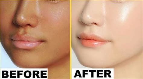 UK's LGA Asks to Avoid All Skin Whitening Creams At All Costs