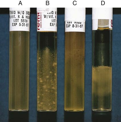 Thioglycollate broth: Composition, Principle, and Uses • Microbe Online