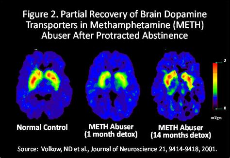 DrugFacts: Methamphetamine | National Institute on Drug Abuse (NIDA)