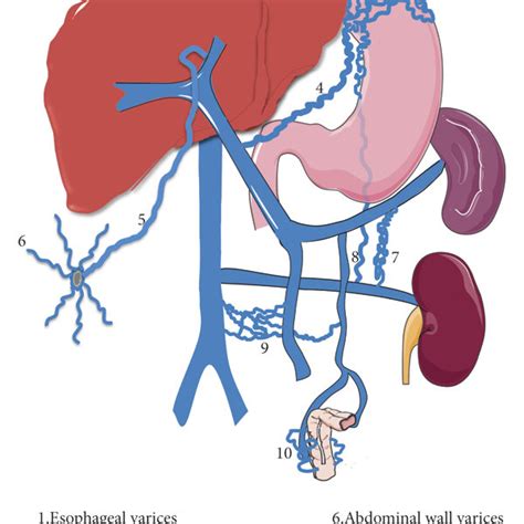 Left gastric vein. A 76-year-old female with a three-year history of... | Download Scientific ...