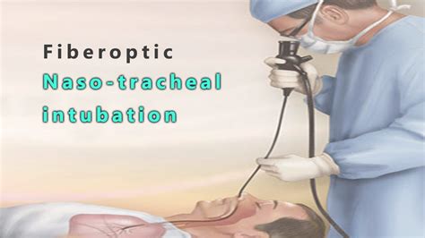 Nasotracheal Intubation Indications