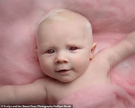 Woman, 22, told she had a 10% chance of conceiving has an ALBINO baby | Family Health Tale