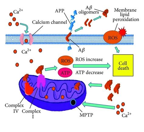 Mitochondrial damage in Alzheimer's disease. Amyloid-β (Aβ ...