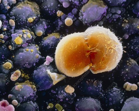 F. colour SEM of a dividing primordial germ cell - Stock Image - P632/0023 - Science Photo Library