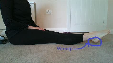 What to do with those hyperextending knees - The Dance Physio