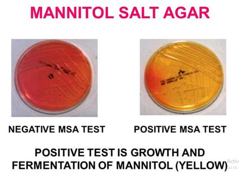 Mannitol Salt Agar Its Principle, Composition, Results, 54% OFF