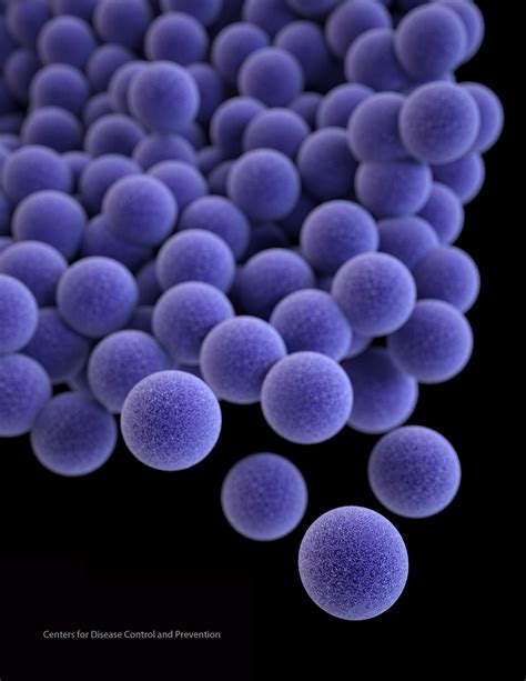 Staphylococcus aureus