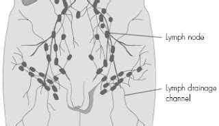 Lymphedema of the leg: Images Male Pelvic Lymph Nodes