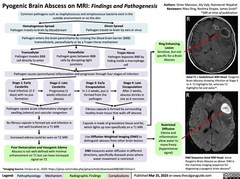 Pyogenic Brain Abscess on MRI: Findings and Pathogenesis | Calgary Guide