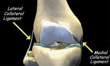 Lateral Collateral Knee Ligament Injury: Background, Functional Anatomy ...