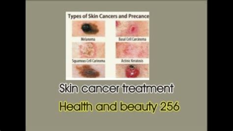 skin cancer treatment method 2018 |therapy|surgery - YouTube