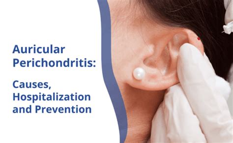 Auricular Perichondritis: Causes, Hospitalization, and Prevention | Rhinoplasty Surgeon India