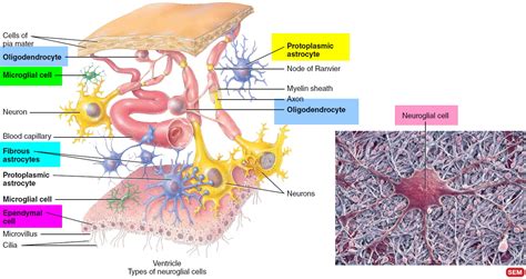 Astrocytoma - Causes, Grades, Symptoms, Prognosis, Treatment