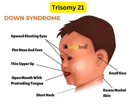 Fetal Chromosomal Aneuploidy: What It Is & Why It Matters?