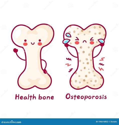 Osteoporosis Cartoon Bone Vector Illustration | CartoonDealer.com #91167622