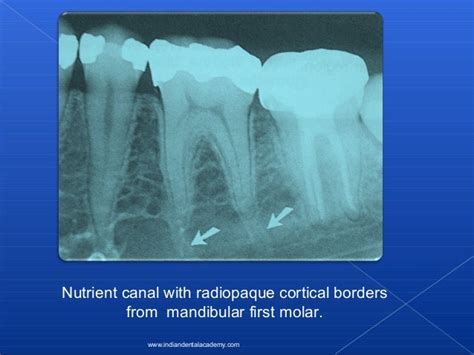 Lamina dura/ oral surgery courses