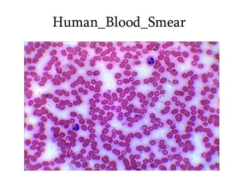 1 human blood, smear