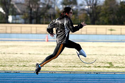 Beautiful takes prosthetic – Telegraph