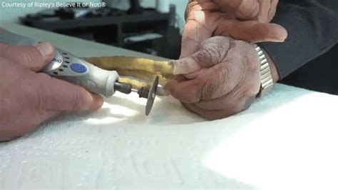 82 Year Old Man With the World's Longest Fingernails Cuts Them Off After 66 Years