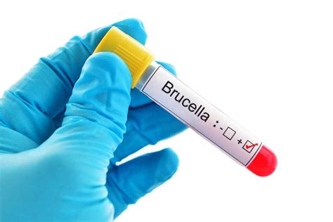 Brucellosis: Symptoms, Causes, and Treatment