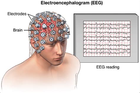 3: Electroencephalogram | Download Scientific Diagram