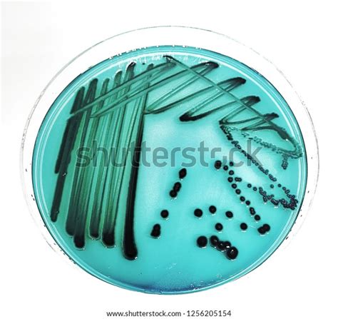 6 imágenes de Hektoen enteric agar - Imágenes, fotos y vectores de stock | Shutterstock