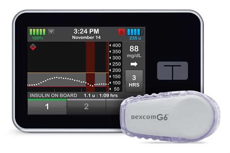 Tandem’s Control-IQ Explained | Tandem insulin pump, Type one diabetes ...