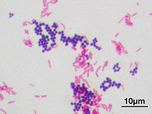 Gram-positive bacteria - Wikipedia