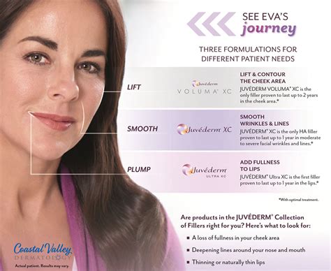 Juvederm - Coastal Valley Dermatology