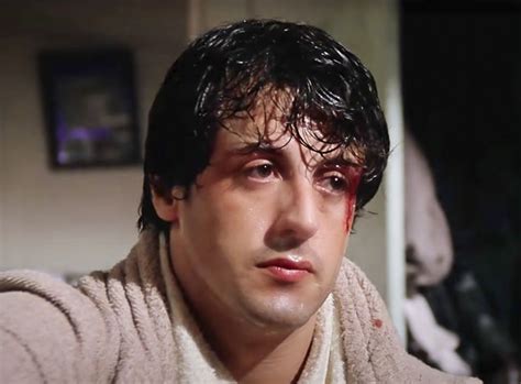 a man in a bathrobe looking at the camera with blood on his face