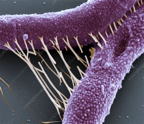 Anthrax bacteria, SEM - Stock Image - C006/3115 - Science Photo Library