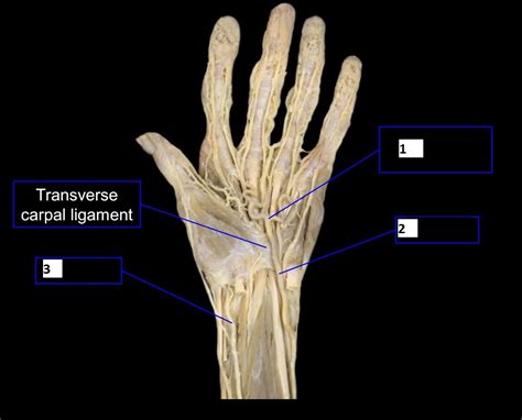 Answered: 1 Transverse carpal ligament | bartleby