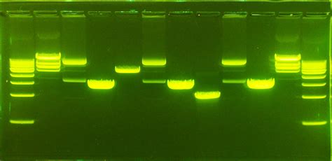 Gel Electrophoresis - DNA - GelGreen | Dna art, Gel, Science