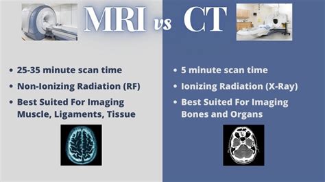 MRI vs CT Scan: What’s The Difference? : r/GE_MRI