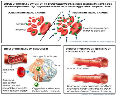 Hyperbaric Oxygen Therapy - Utah Body and Soul