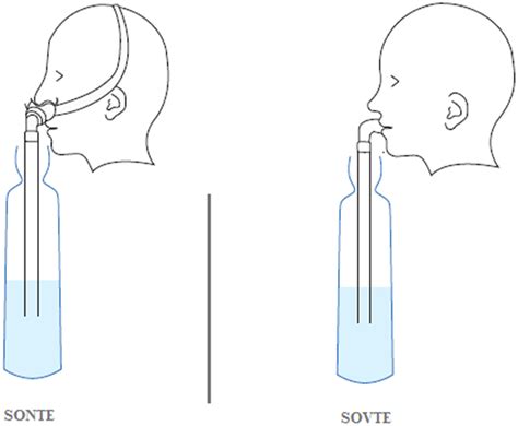 Semi-occluded Nasal Tract Exercises (SONTEs): Nasal Tube in Water Exercises Using Nasal ...