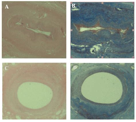 Histology results from two arterial samples. | Download Scientific Diagram