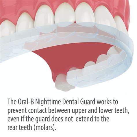 Oral-B Nighttime Dental Guard, Less Than 3-Minutes for Custom Teeth Grinding Protection with ...