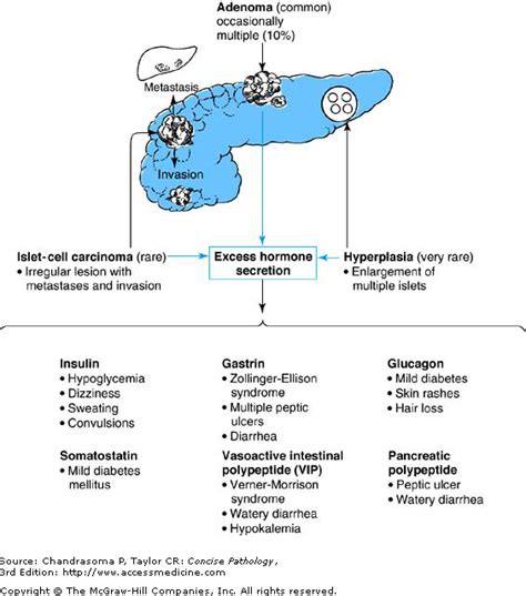 Hyperinsulinemia Hypoglycemia Precipitated By Weight Loss - Modus Operandi