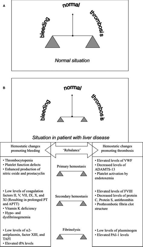 Deranged hepatic synthesis and rebalancing of pro, anti-coagulant and... | Download Scientific ...