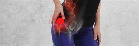 FAQs About Torn Hip Labrum Injuries | Rothman Orthopaedic Institute